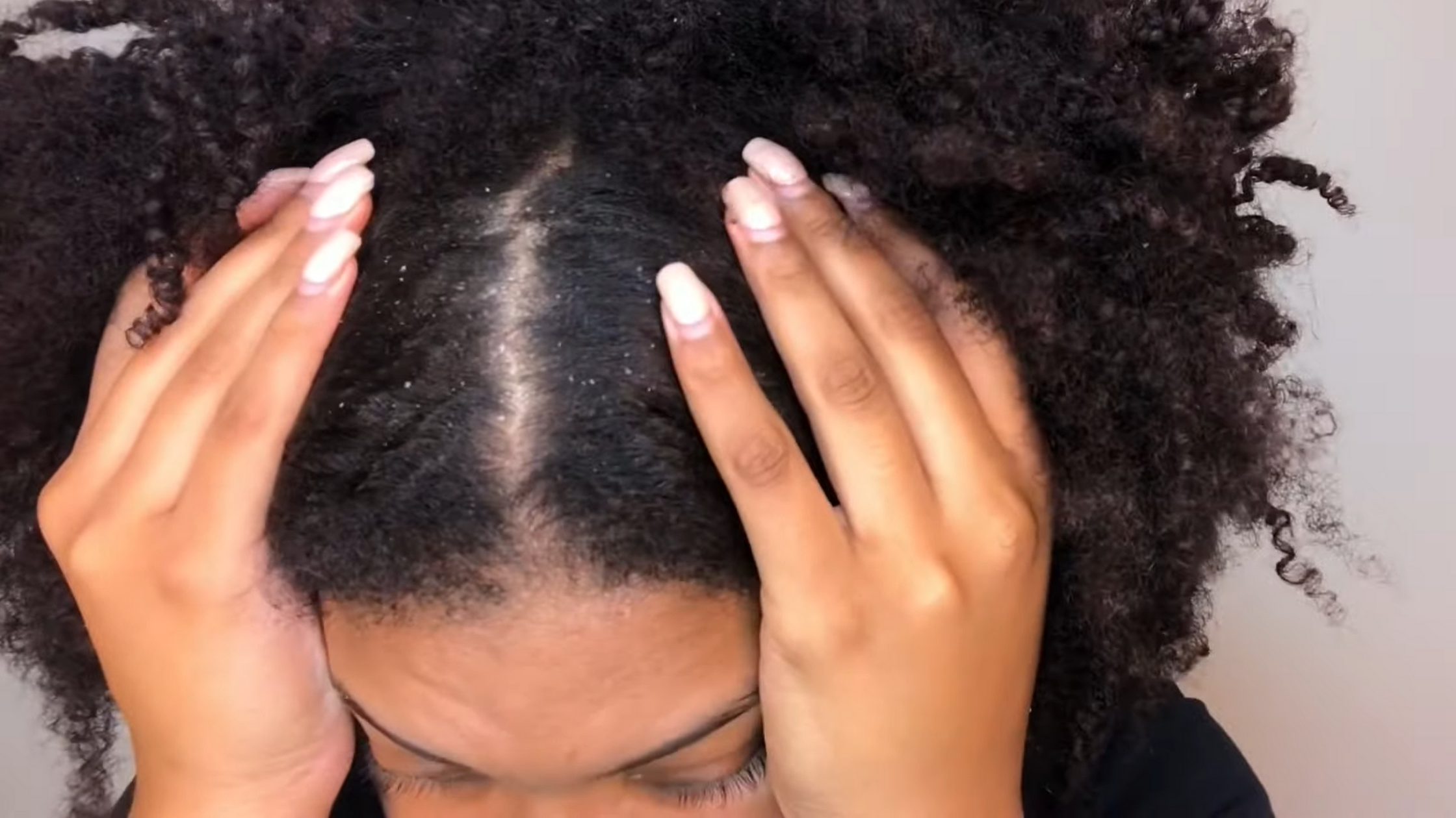 Home Remedies For Dry Scalp Treatment Beginners-Friendly ⋆ African American  Hairstyle Videos - AAHV